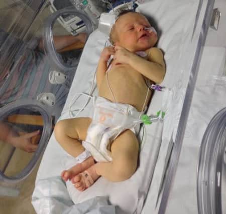 Noah Walton, of Broughton, at 12 days old at Alder Hey Children's Hospital