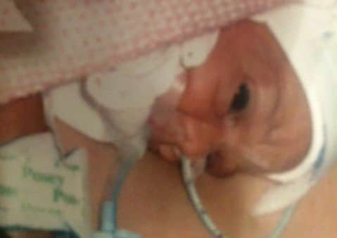 Carla Sofia was born at just 23 weeks