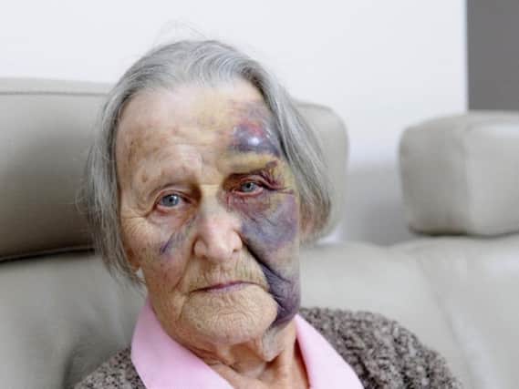 Evelyn Birchall, who was attacked at home