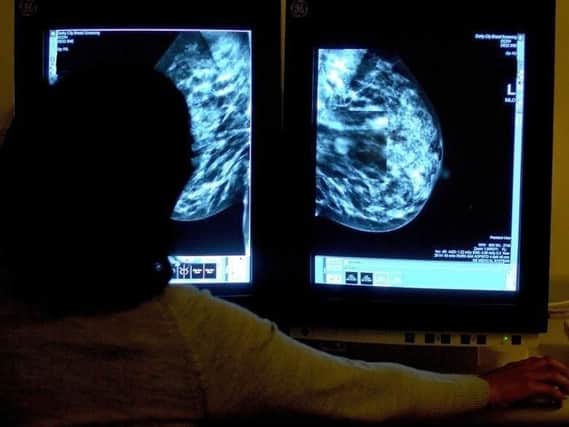 Women in England between the ages of 50 and 70 are currently automatically invited for breast cancer screening