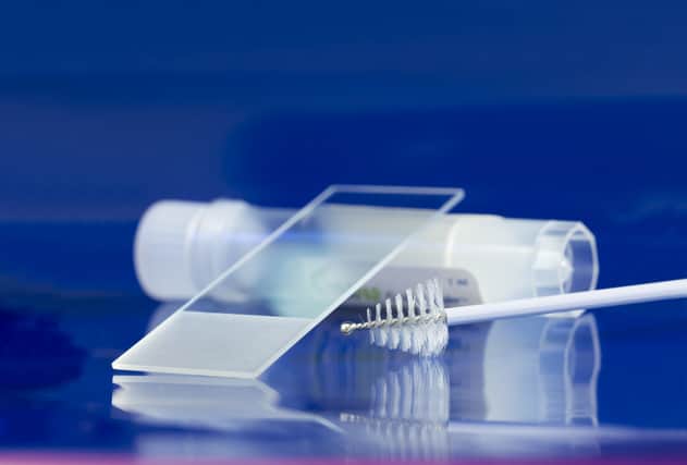 The kits will be sent to women between 25 and 64 years old who are 15 months overdue for a check (Photo: Shutterstock)